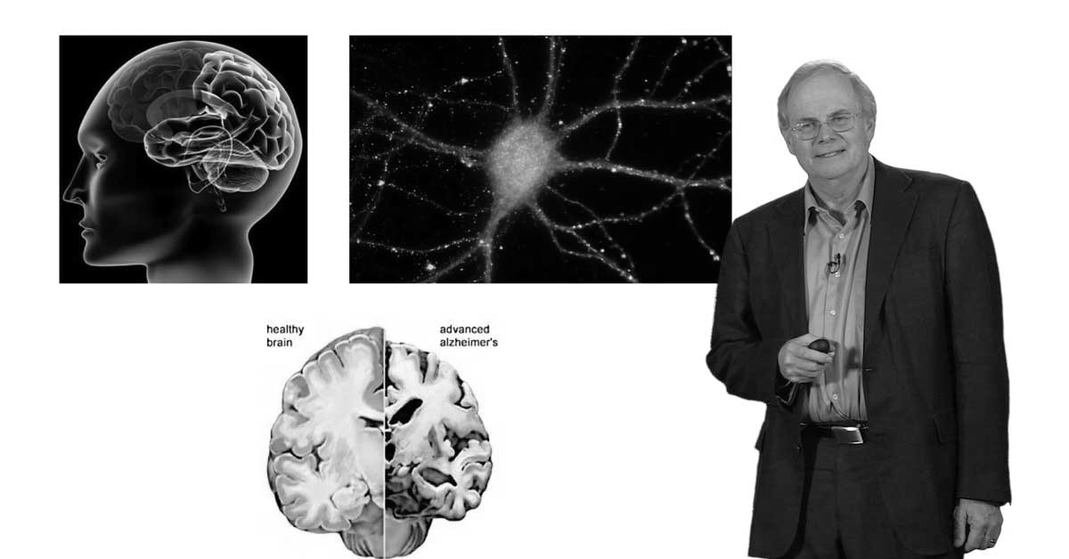 Understanding Neurodegenerative Diseases: Causes and Risk Factors