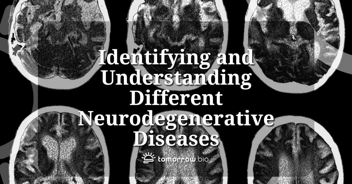 Symptoms and Progression of Neurodegenerative Diseases